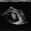 Baby Errico @ 8 weeks 6 days.jpg