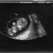 Baby Errico @ 9 weeks 6 days (1).jpg